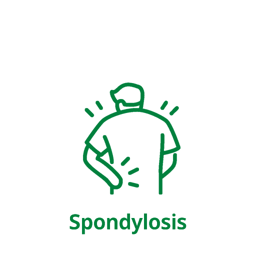 Spondylosis