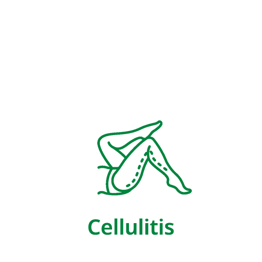 Cellulitis